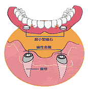 磁性イラスト