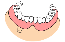 総入れ歯