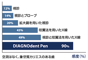 ダイアグノデントデータ